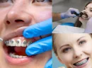 Düzce Ortodonti Doktorları Hangi Tedavileri Uygular?