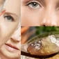 Kolajen Nedir?